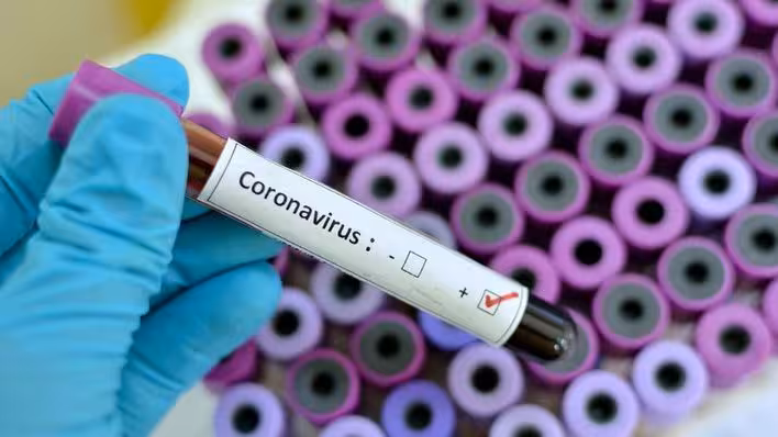 Baleares tiene ya 112 casos de afectados por coronavirus, 20 más que ayer